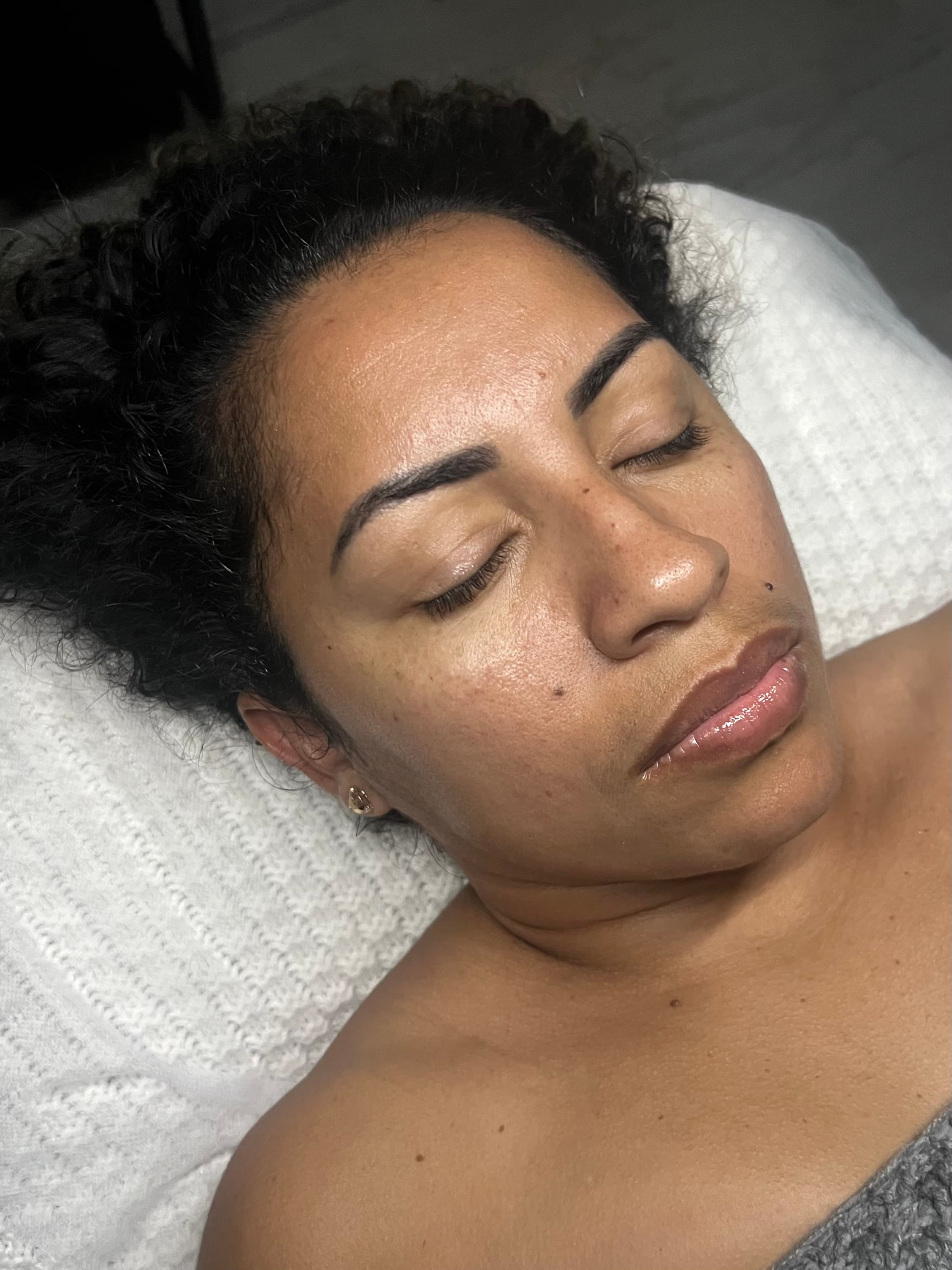 Antes - Facial Express Glow